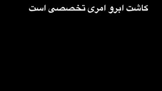 کاشت ابرو رنسانس