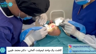 ویدیو کاشت 1 واحد ایمپلنت آلمانی در شیراز - دکتر محمد طیبی