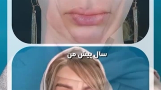 دکتر یوسف شفایی خانقاه ابرسانی پوست