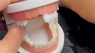 پروتز دندان جادوئی